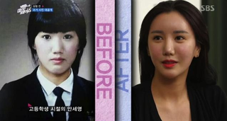 Illustration for article titled Depressing? Inspirational? Reverse Plastic Surgery Show Hits Korea